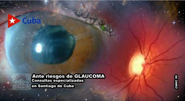 Ante riesgos de Glaucoma, especialistas en Santiago de Cuba tienen respuestas actualizadas. Foto: Santiago Romero Chang